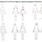 Marking of Use-of-Force Injuries Against Immigrants Detained at Ft. Bliss. Source: ACLU.