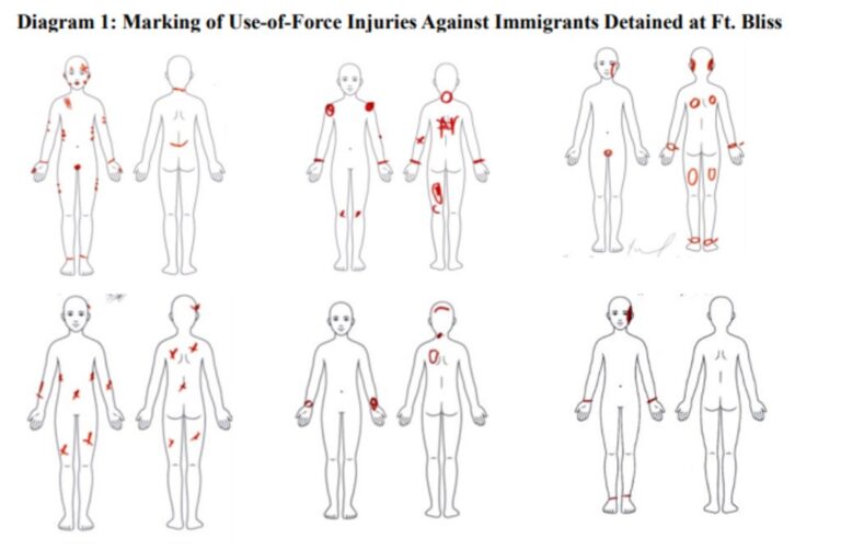 Marking of Use-of-Force Injuries Against Immigrants Detained at Ft. Bliss. Source: ACLU.